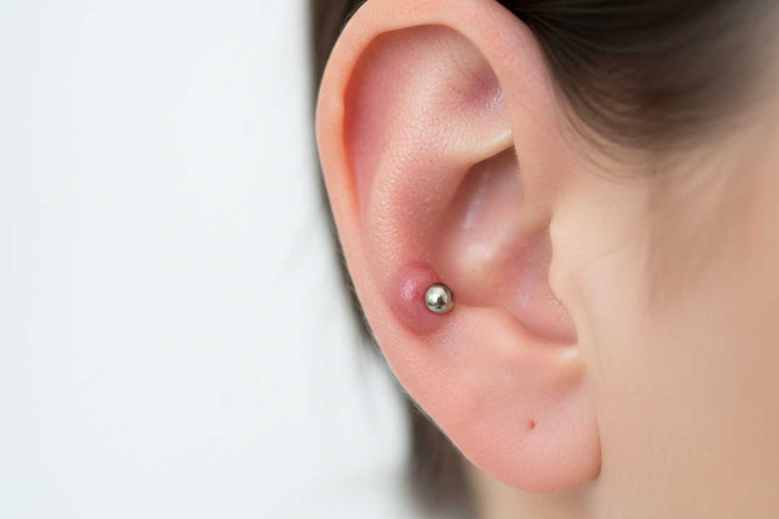person with a keloid on ear