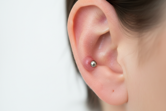 person with a keloid on ear